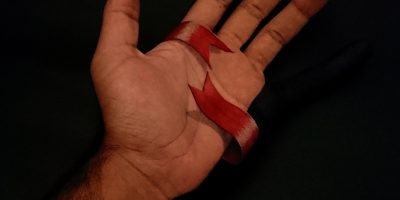 عجایب خلقت! دست چهار انگشتی